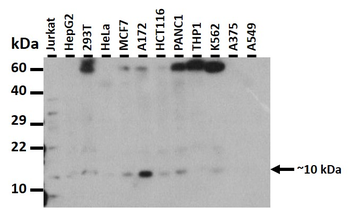 PLAC9 Rabbit Polyclonal Antibody