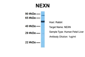 NEXN Rabbit Polyclonal Antibody