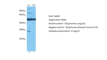 NEXN Rabbit Polyclonal Antibody
