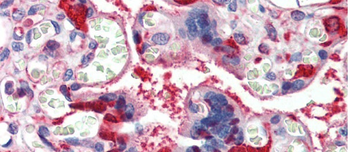 LDHB Rabbit Polyclonal Antibody