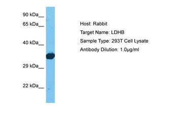 LDHB Rabbit Polyclonal Antibody