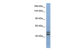 TEX10 Rabbit Polyclonal Antibody