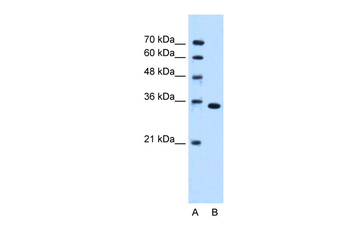TYMS Rabbit Polyclonal Antibody