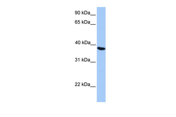 NAA80 Rabbit Polyclonal Antibody