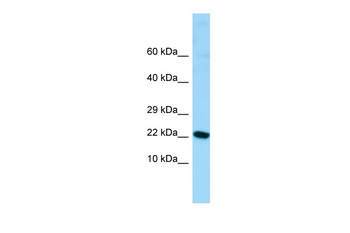 ALG13 Rabbit Polyclonal Antibody