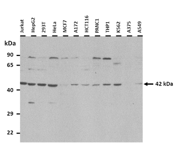 AS3MT Rabbit Polyclonal Antibody