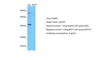 AS3MT Rabbit Polyclonal Antibody