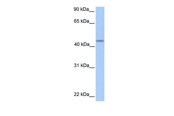 PNPLA5 Rabbit Polyclonal Antibody