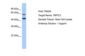 TMTC2 Rabbit Polyclonal Antibody