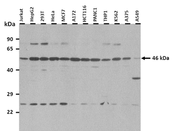 METT5D1 Rabbit Polyclonal Antibody