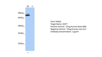 GGTL3 Rabbit Polyclonal Antibody