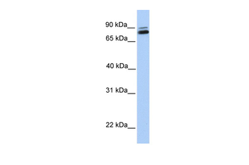 GGTL3 Rabbit Polyclonal Antibody
