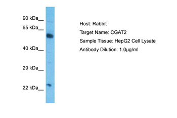 CSGALNACT2 Rabbit Polyclonal Antibody