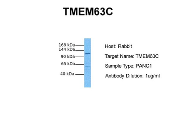 TMEM63C Rabbit Polyclonal Antibody