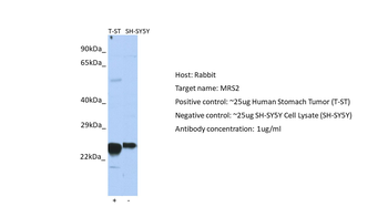 MRS2L Rabbit Polyclonal Antibody
