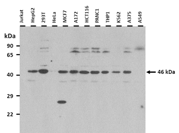 Aadacl1 Rabbit Polyclonal Antibody