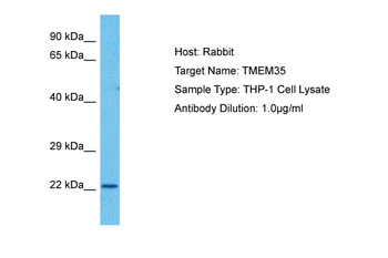 TMEM35A Rabbit Polyclonal Antibody