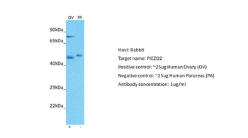 PIEZO2 Rabbit Polyclonal Antibody