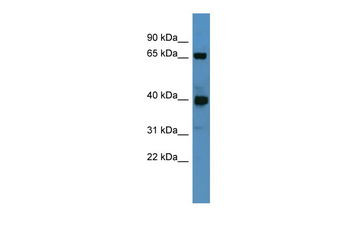 Galnt11 Rabbit Polyclonal Antibody