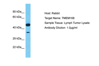 TMEM168 Rabbit Polyclonal Antibody