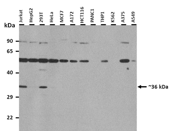 C20orf116 Rabbit Polyclonal Antibody
