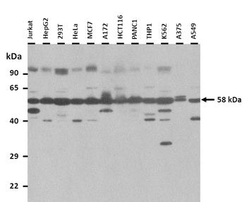 TTYH3 Rabbit Polyclonal Antibody