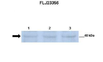 POMK Rabbit Polyclonal Antibody