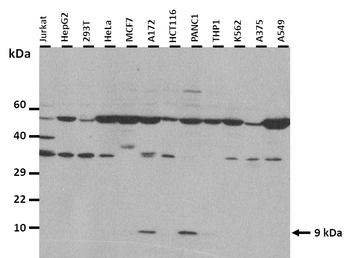 NMES1 Rabbit Polyclonal Antibody