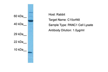 NMES1 Rabbit Polyclonal Antibody