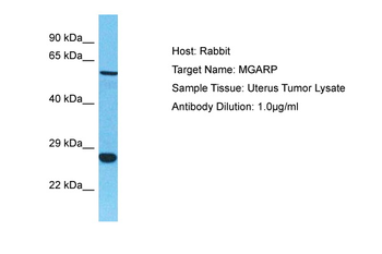MGARP Rabbit Polyclonal Antibody