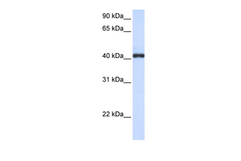 FCRLA Rabbit Polyclonal Antibody