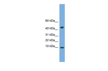 ATP5MD Rabbit Polyclonal Antibody