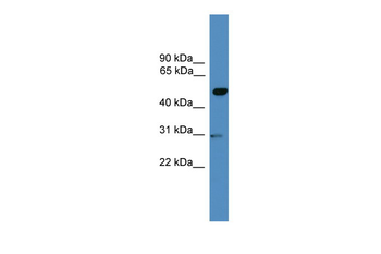 GAL3ST3 Rabbit Polyclonal Antibody