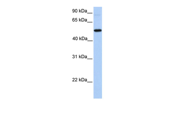 GALNT13 Rabbit Polyclonal Antibody