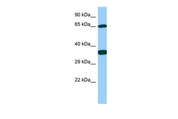 Galnt13 Rabbit Polyclonal Antibody