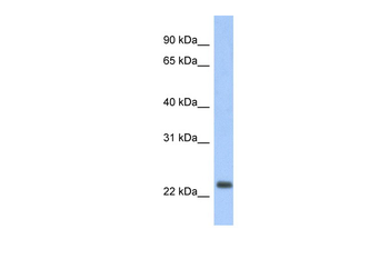 ND6 Rabbit Polyclonal Antibody