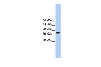 TMC2 Rabbit Polyclonal Antibody