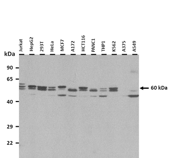ZNF835 Rabbit Polyclonal Antibody