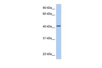 ARID3C Rabbit Polyclonal Antibody