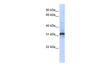 ZNF705D Rabbit Polyclonal Antibody