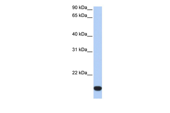 FLJ44894 Rabbit Polyclonal Antibody