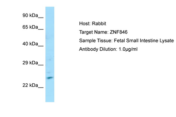 ZNF846 Rabbit Polyclonal Antibody