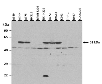 KIAA1627 Rabbit Polyclonal Antibody