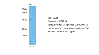 KIAA1627 Rabbit Polyclonal Antibody