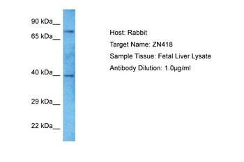 ZNF418 Rabbit Polyclonal Antibody
