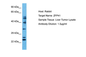ZFP41 Rabbit Polyclonal Antibody