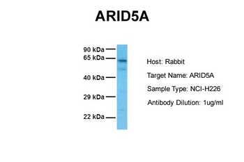 ARID5A Rabbit Polyclonal Antibody