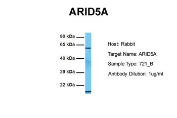 ARID5A Rabbit Polyclonal Antibody