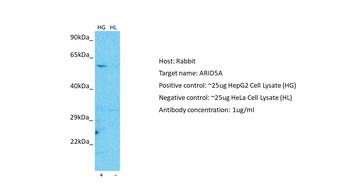 ARID5A Rabbit Polyclonal Antibody