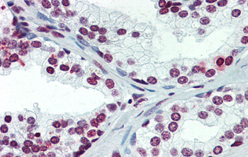 ARID5A Rabbit Polyclonal Antibody